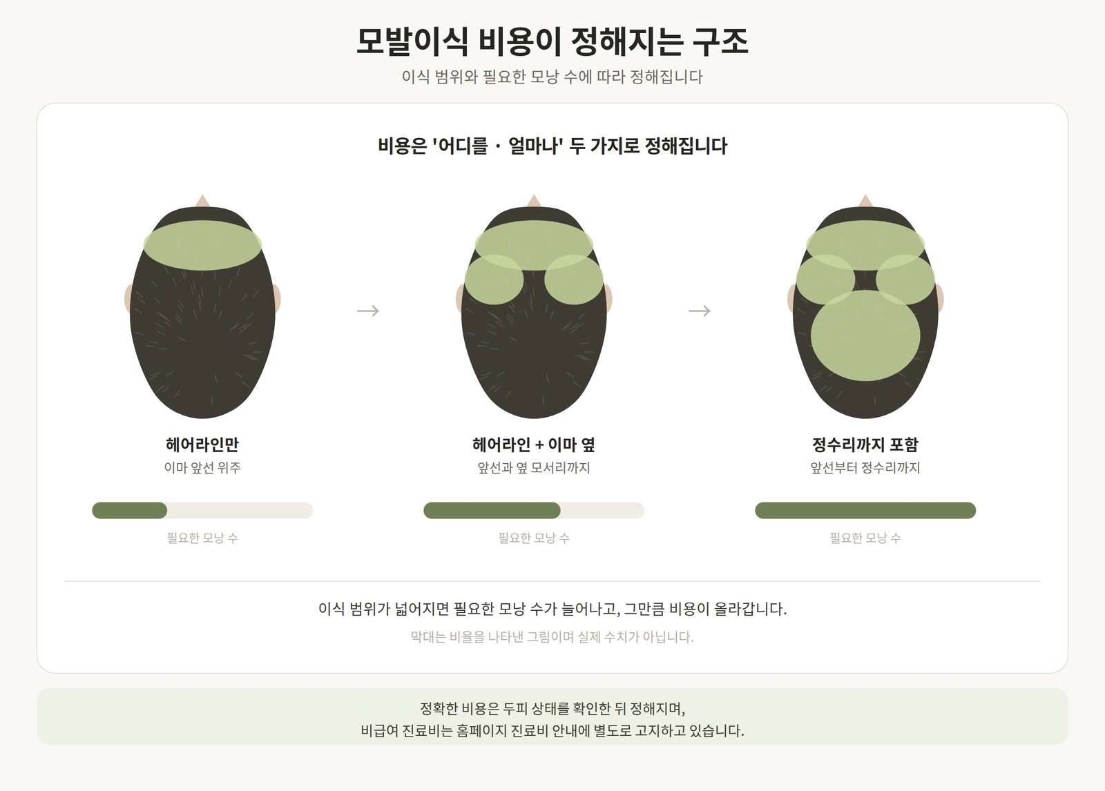 모발이식 비용이 이식 범위와 필요한 모낭 수에 따라 정해지는 구조를 나타낸 도해