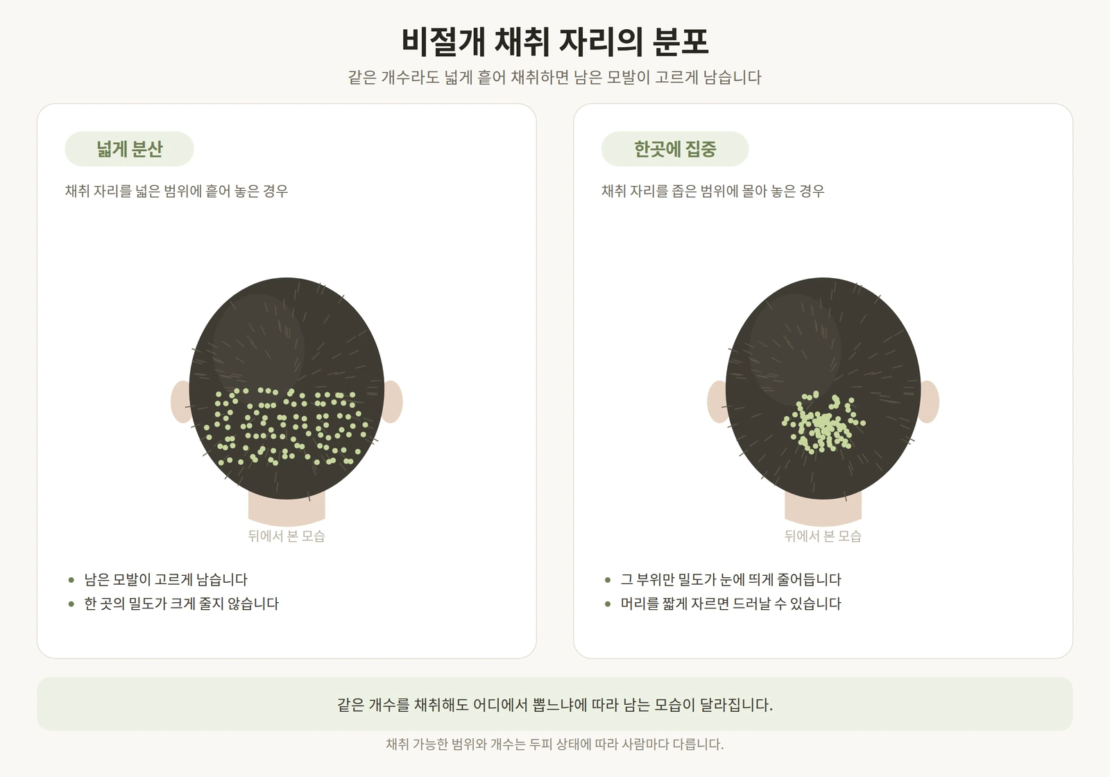 비절개 모발이식에서 채취 자리를 넓게 분산한 경우와 한곳에 집중한 경우를 비교한 후두부 도해