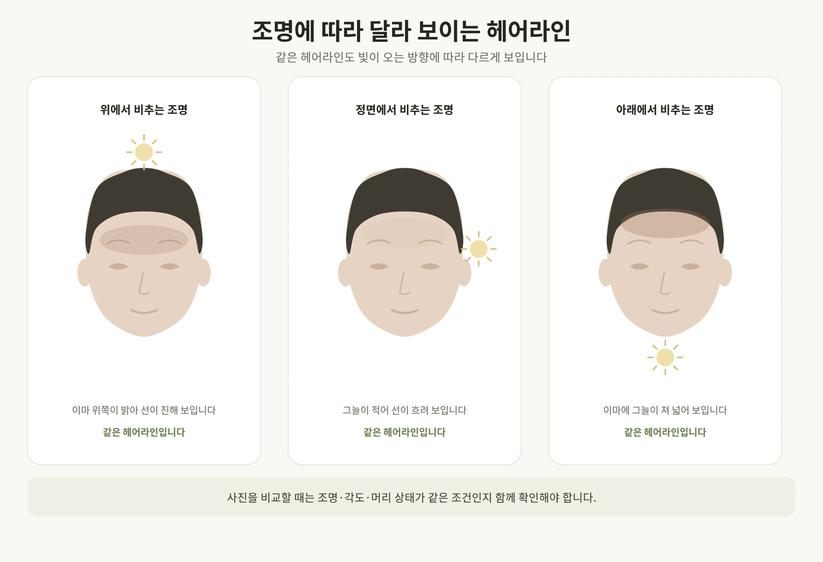 같은 헤어라인이 조명 방향에 따라 다르게 보이는 차이를 비교한 도해