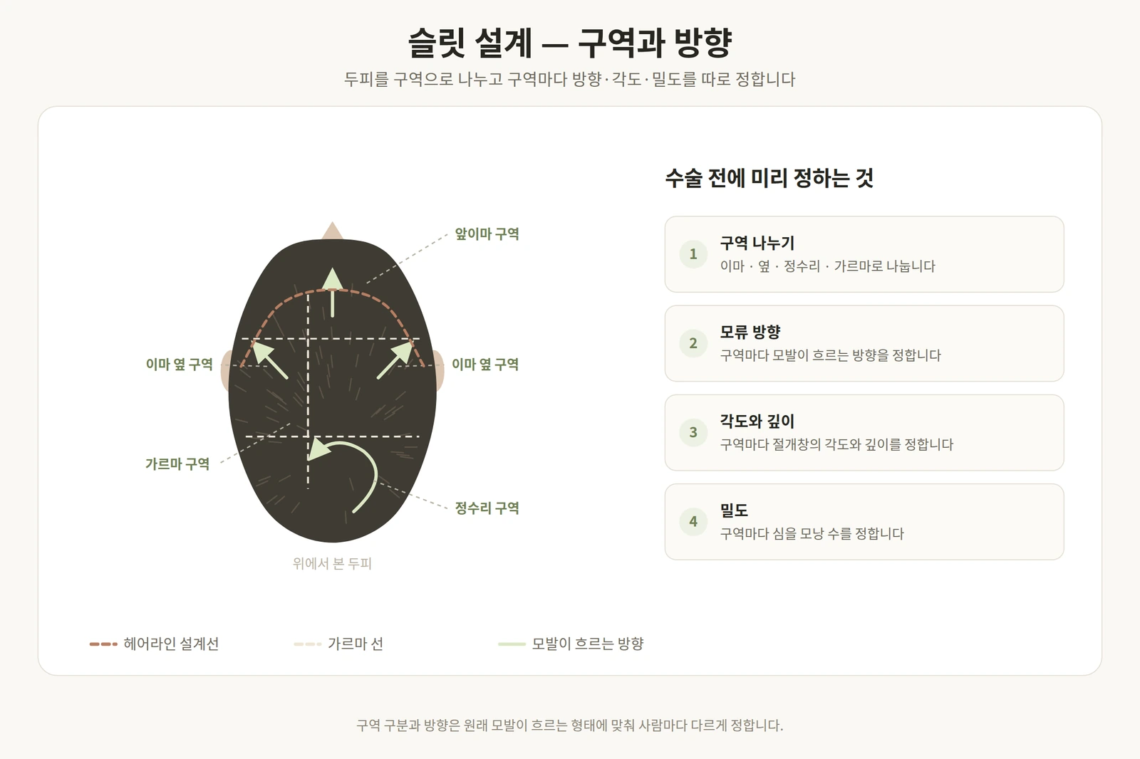 두피를 구역으로 나누고 구역마다 모발이 흐르는 방향을 표시한 슬릿 설계 도해