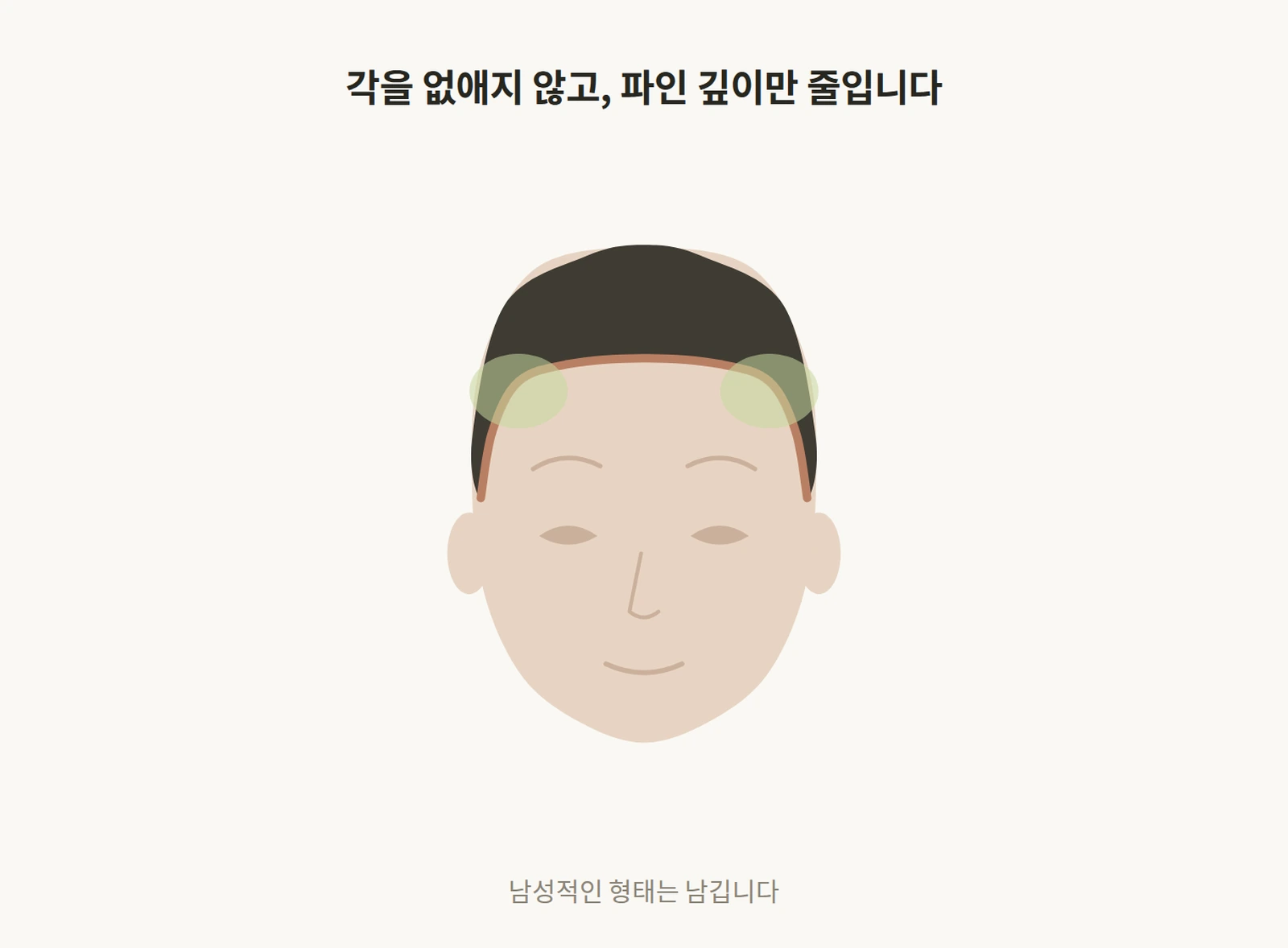 이마 모서리의 각은 유지하며 파인 깊이만 줄이는 교정 도해