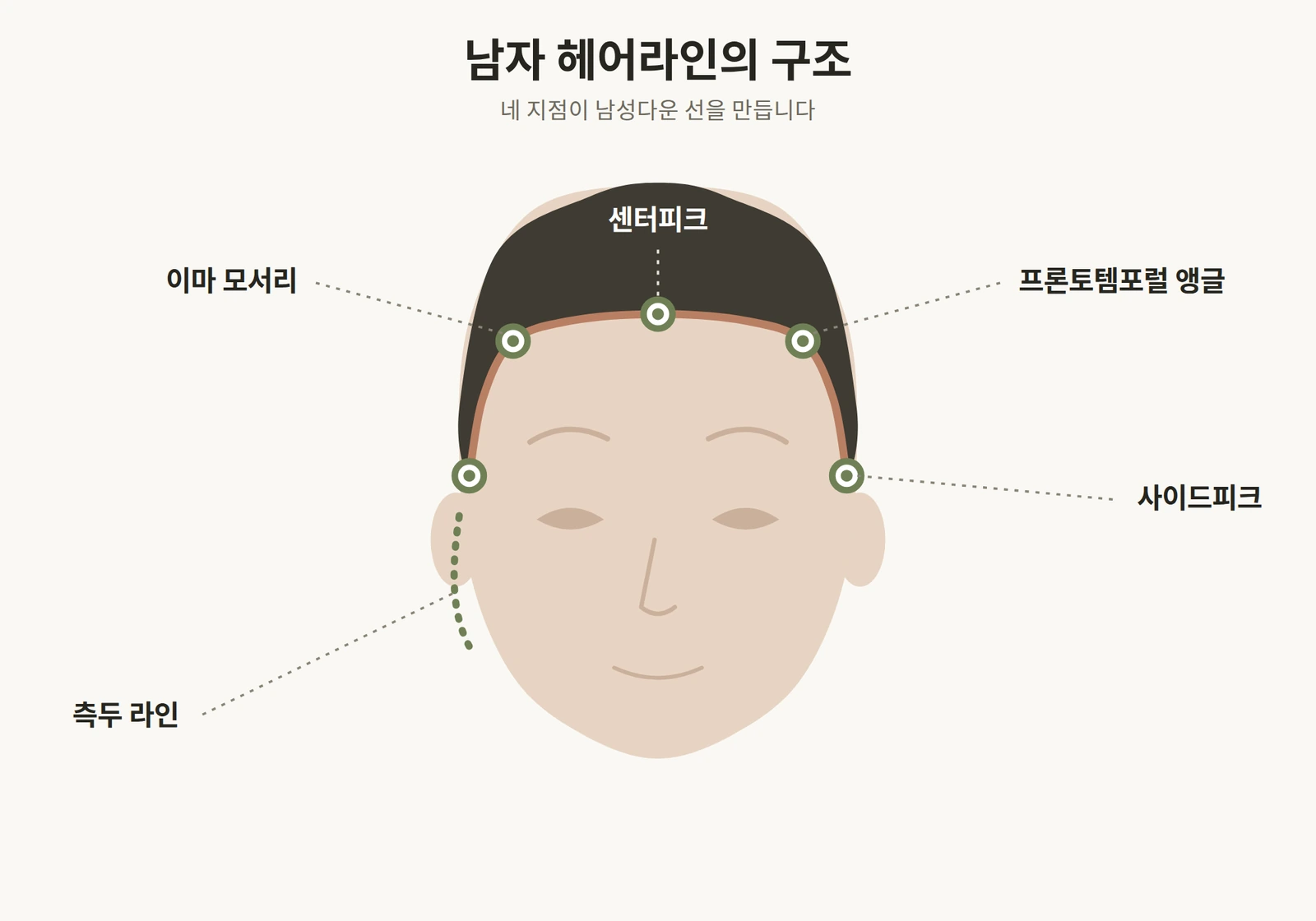 센터피크와 프론토템포럴 앵글 등 남성 헤어라인 구조 도해