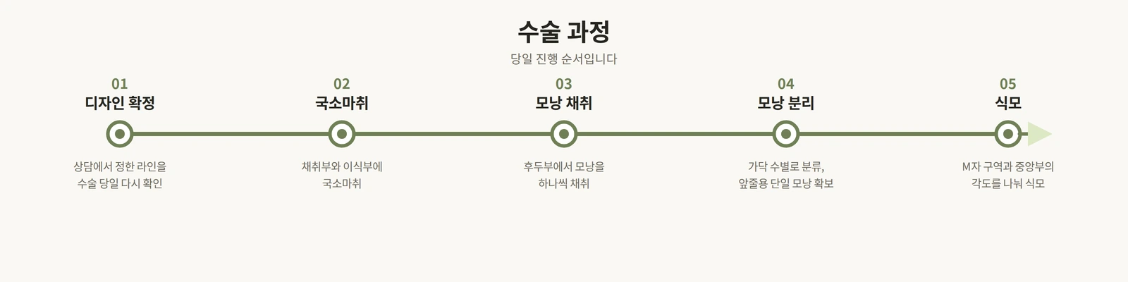 디자인 확정부터 식모까지 수술 당일 다섯 단계 순서도