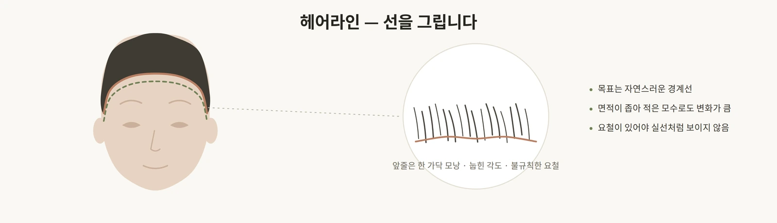 헤어라인 교정은 경계선을 그리는 작업임을 설명하는 도해